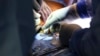 Hirurzi izvode prvu na svijetu genetski modificiranu transplantaciju bubrega svinje u živog čovjeka u Opštoj bolnici Massachusetts, u Bostonu, 16. marta 2024. 
