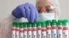 FILE - Test tubes labelled 'Bird Flu', are seen in this picture illustration, Jan. 14, 2023. 