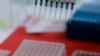 Научниците предупредуваат на пандемија на птичји грип која се одвива бавно 