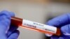 Tabung reaksi dengan label nama virus corona terlihat dalam gambar ilustrasi yang diambil pada 29 Januari 2020. (Foto: Reuters/Dado Ruvic)