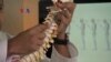 Gangguan Tulang Belakang akibat Smartphone