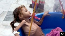 Seorang gadis yang menderita kekurangan gizi ditimbang di Pusat Kesehatan Aslam di Hajjah, Yaman, 25 Agustus 2018. (Foto: dok).