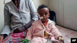 Yordanos Mebrahtiu, 1, is treated for malnutrition at the Ayder Referral Hospital in Mekele, in the Tigray region of northern Ethiopia, Oct. 4, 2022.