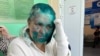 In the Optics of Russian Media, Journalist Attacked in Chechnya Deserved Worse
