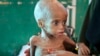 Risiko Kematian Akibat Kelaparan di Afrika Semakin Besar