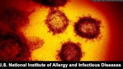 Kluster virus SARS-CoV-2 (severe acute respiratory syndrome coronavirus 2) yang menyebabkan COVID-19 tampak dari mikroskop. (Foto: Institut Nasional Alergi dan Penyakit Menular AS)